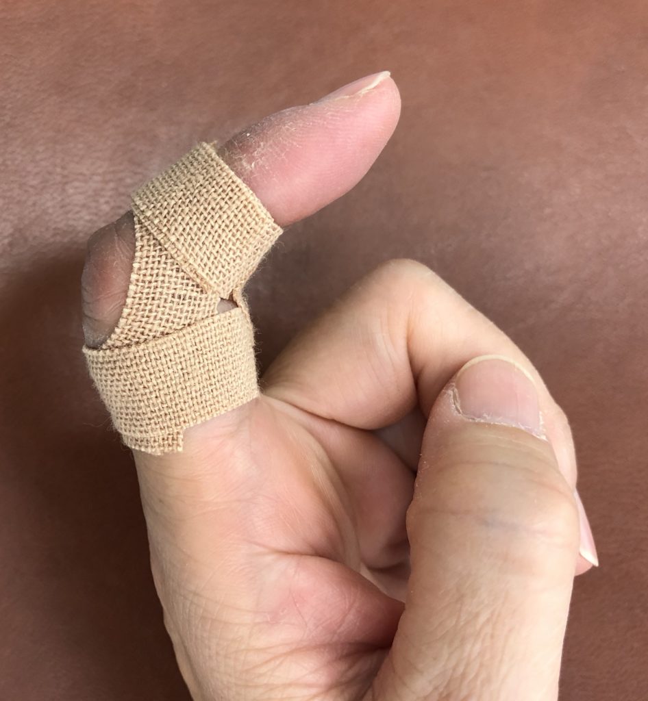 突き指の固定 それで大丈夫ですか 第二わしざわ整形外科 ブログ